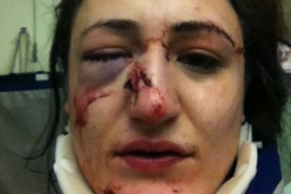 Polizeigewalt auch gegen Frauen! Diese kriminellen BRD-Dienstausweisträger gehören alle in den Knast!